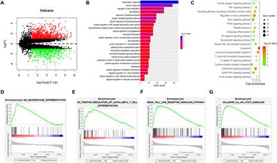 Integrated Transcriptional Profiling Analysis and Immune-Related Risk Model Construction for Intracranial Aneurysm Rupture